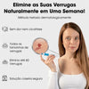 DermaCore Tratamento para Acrocórdons