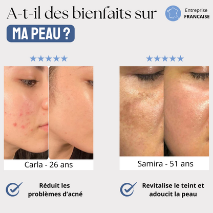 Pommeau de douche filtrant anti-impuretés™