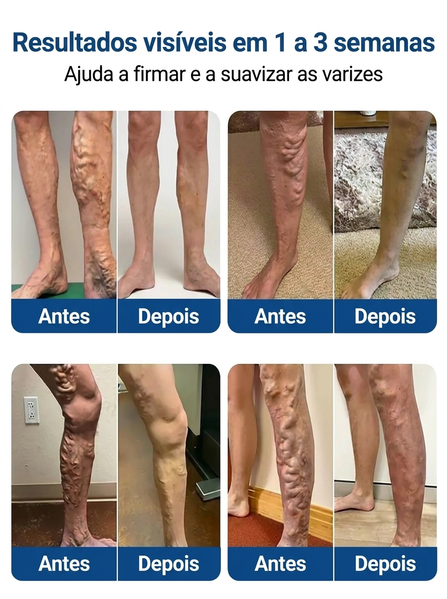 Patch Pernas Leves Pro Conforto