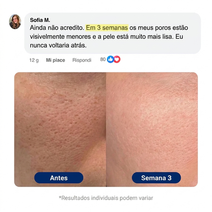 Pele Pura Coreana