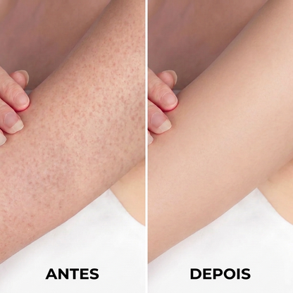 Esponja Esfoliante para o Corpo – Esfolia, Limpa e Suaviza a Pele