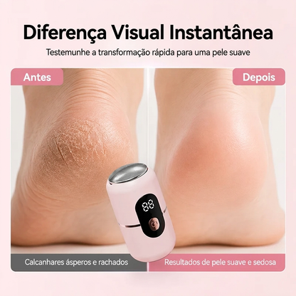 Lima Elétrica para Pés Profissional